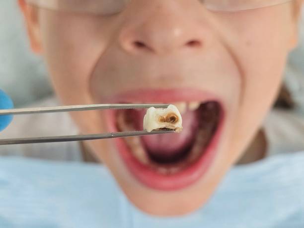 Best Emergency Treatment for Jaw Pain or Injury in Belen, NM
