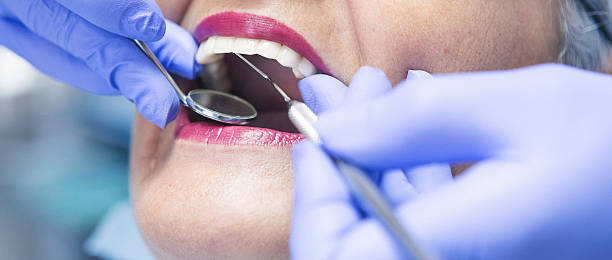 Best Broken or Chipped Tooth Repair in Belen, NM